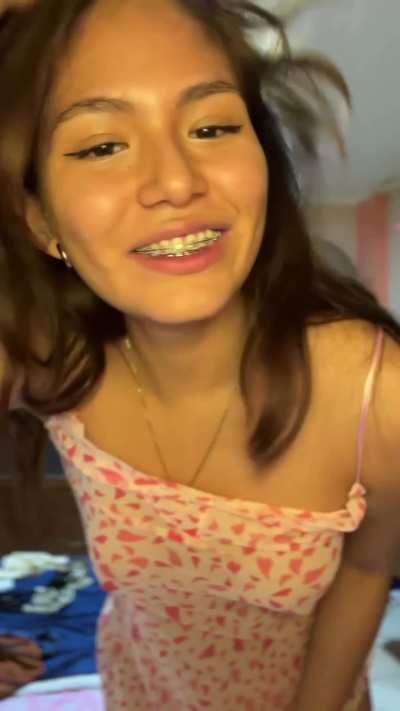 I hope older men find me attractive even though i have braces and just 18 yo