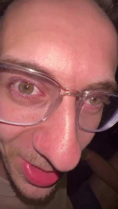 Not fixed but definitely the stitch improved this messy boy