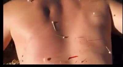 Too many chromosomes