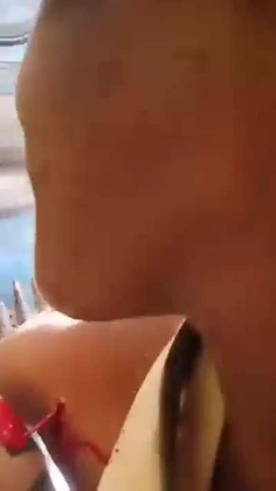 RSF fighter gets shot in the axilla while filming .west Kordofan-  Sudan 14/5/2025