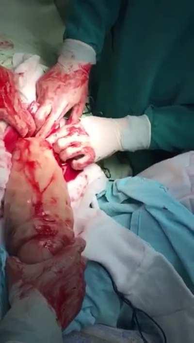 Remove Absolute Massive Toy after getting stuck up