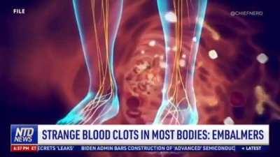 Mysterious Fiber Clots Are Being Found in Corpses Recently