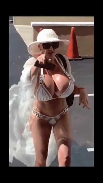 @tammyhtherealtor 4,200 saline expander breast implants. 850cc butt implants