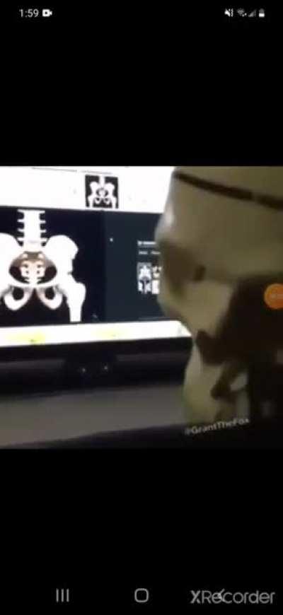 Has to rember to delete search history