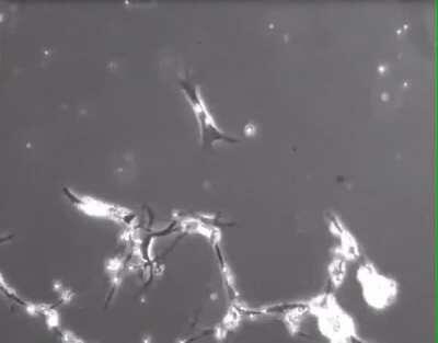 This is a timelapse of neurons making new connections to other neurons. This is what your thoughts look like