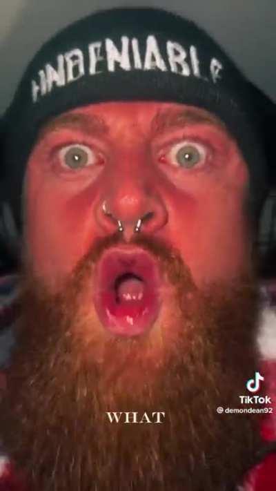 I’m reminded of that Seinfeld episode where they all go overboard with the teeth whitener