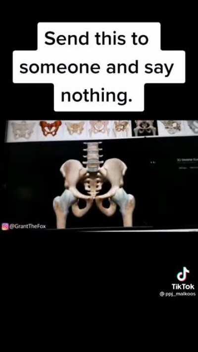 I'm sure henry will get it in no time