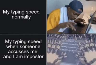 *hands suddenly start sweating*