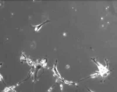 Time-Lapse Footage Of Neurons Making New Connection To Other Neurons In the Brain. This Is What Thoughts Look Like