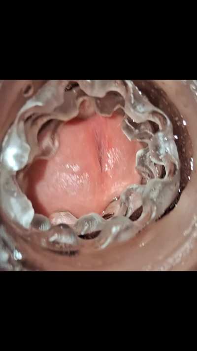 It just all came out at once!