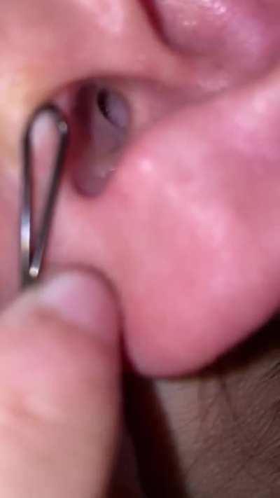 There was a spider inside my ear