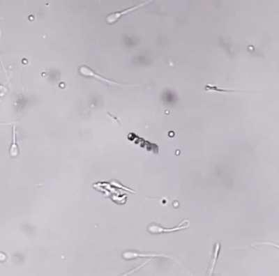 A nanorobot takes the sperm and carries it to the egg cell, performing the fertilization process.