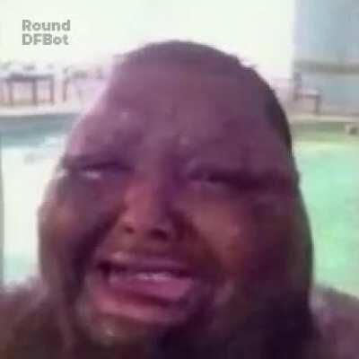 Oh mi lente de contacto