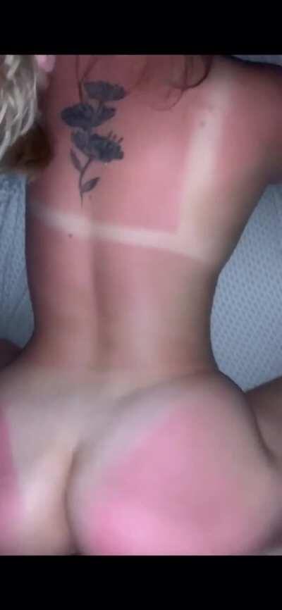 Don’t worry I applied aloe on her shortly after...