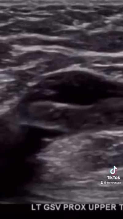 How do you feel? 😳