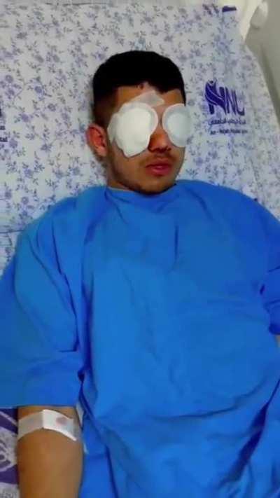 The Palestinian boy Omar Asi lost one of his eyes after being hit with a sound grenade that was thrown by Israeli occupation forces whilst they raided Qarawa Bani Hassan village, northwest of Salfit. (25.4.23)