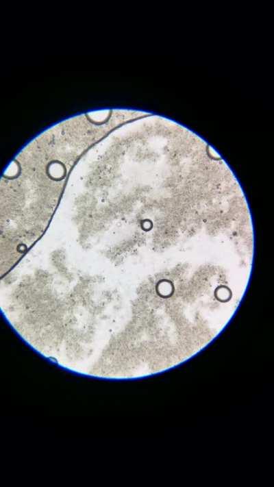 timelapse of yeast making co2 bubbles (15x speed, 1000x magnification)