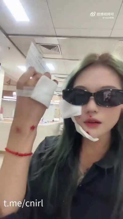 小姐姐摔成这样还在拍视频普法：骑车不要玩手机，要戴好头盔！