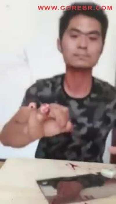 Desculpa a quem tem estômago fraco mas tem que testar o reddit