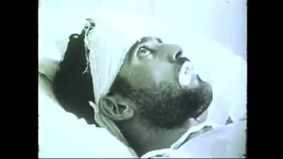 A Man With The Rabies Virus ✨