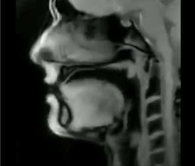 🔥 An MRI of a person talking.