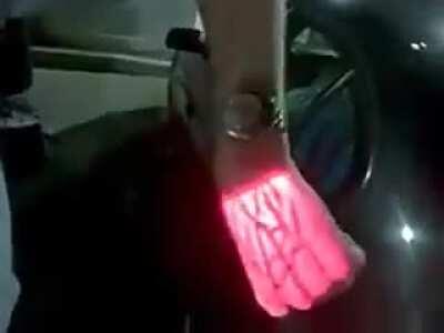 Localizador de veias, são aparelhos que usam luz infravermelha para procurar veias, existem em varias cores e formatos para se adequar a cada situação e paciente.