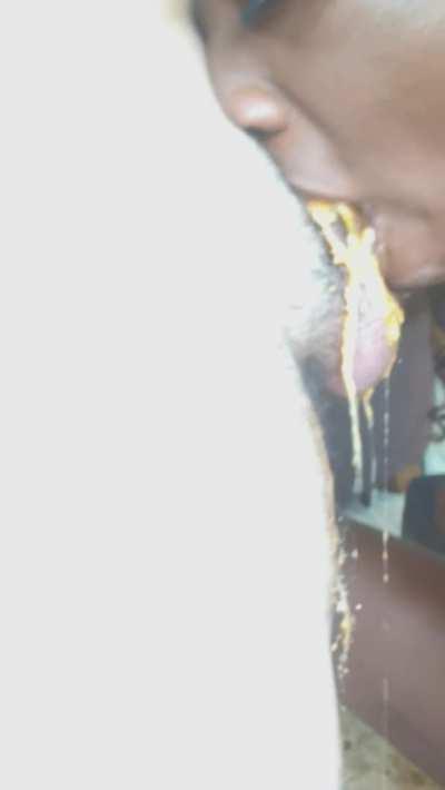 Can you hear my Stomach