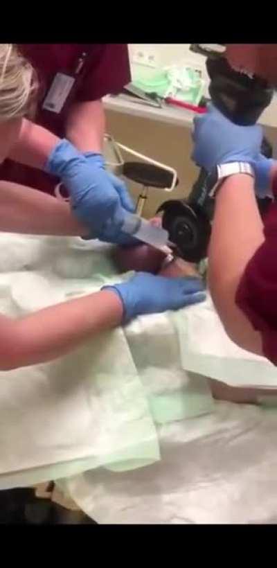 Don't fuck around with metal cock rings