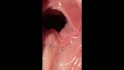 Look how wide my hungry pussy gets after being filled with cock