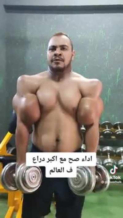 Buna ne demeliyim bilmiyorum