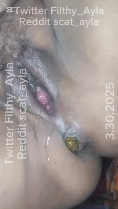 You belong under me and eating my farts and shit [F]