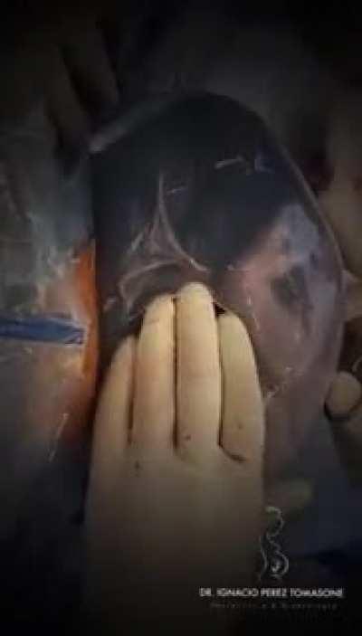 Родиться в рубашке