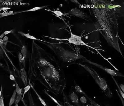 Birth of a neuron. Stem cell differentiating into a brain cell: