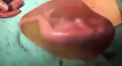 Ever felt your baby moving and wondered what it was doing?