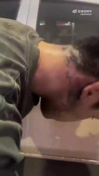 Wcgw Putting Fireworks around you're neck