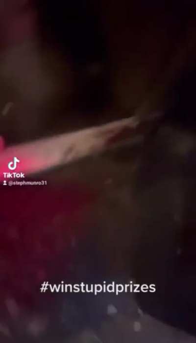 Drunk man falls off bollard and shatters shin