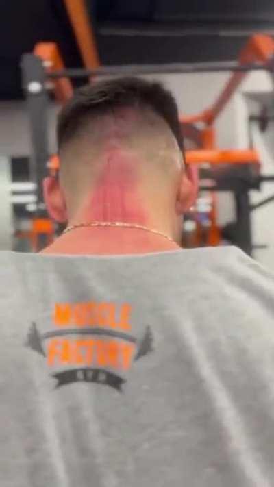 Barbell knurling dragged through the back of his neck with 350lbs of load.
