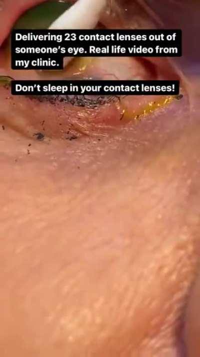 Dont forget to remove them