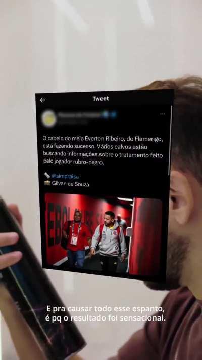 Everton Ribeiro revela como se tornou um ex calvo