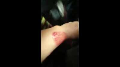 Police, Chatra League and Jubo League jointly attack anti-rape long march in Feni; 25 injured.