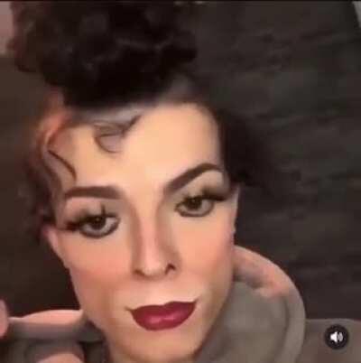 nidalheehee after yet another successful skin bleaching session, courtesy of riot games HQ 😍💉🟤➡️⚪