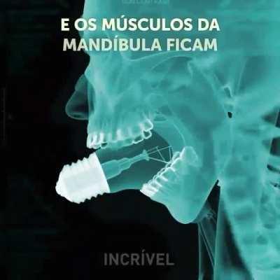 Nunca mamem uma lâmpada!