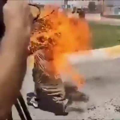 *NSFW* PSA people are not immune to fire