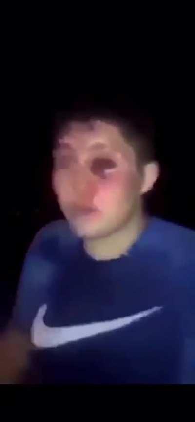 guy eats his own eye on l$d