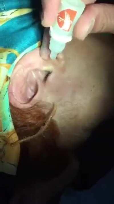 Unexpected thing resurfaces from a ear