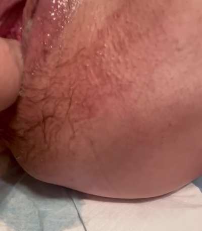 Punch fisting and big gape 😘