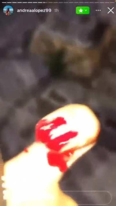 NSFW there is some blood