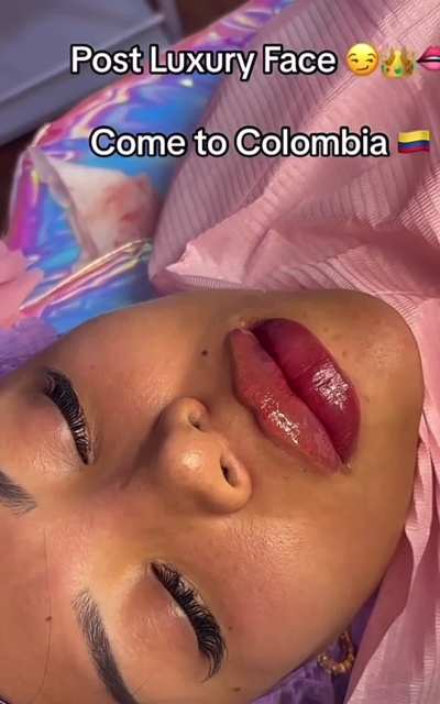 🇨🇴 Getting a luxury face in Bogota