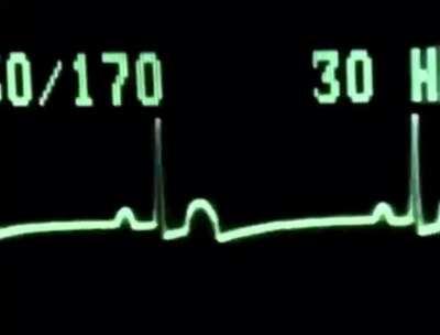 Getting CC-Locked in a Teamfight