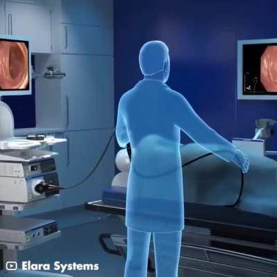 This is how a colonoscopy is performed.
